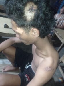 Menanggapi Berita Viral di Tiktok Adanya Begal, Tekab 308 Polres Pesisir Barat Langsung Bergerak, Ternyata itu Korban Laka Lantas