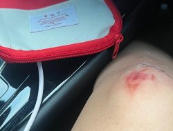 Seorang Wanita Jadi Korban Tabrak Lari di Depan Mall One Bell Park