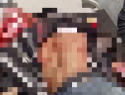 Tukang Ojek Jadi Korban Penganiayaan OTK di Waghete II, Satgas Ops Damai Cartenz Selidiki Pelaku