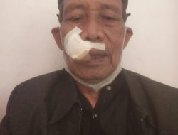 Korban penganiayaan yang blum juga di tanggapi Laporannya pihak ke polisian Jakarta timur.